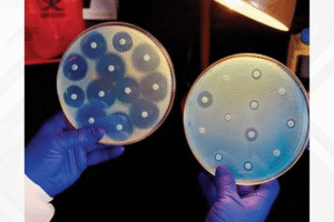Petri dish showing zones of growth inhibition