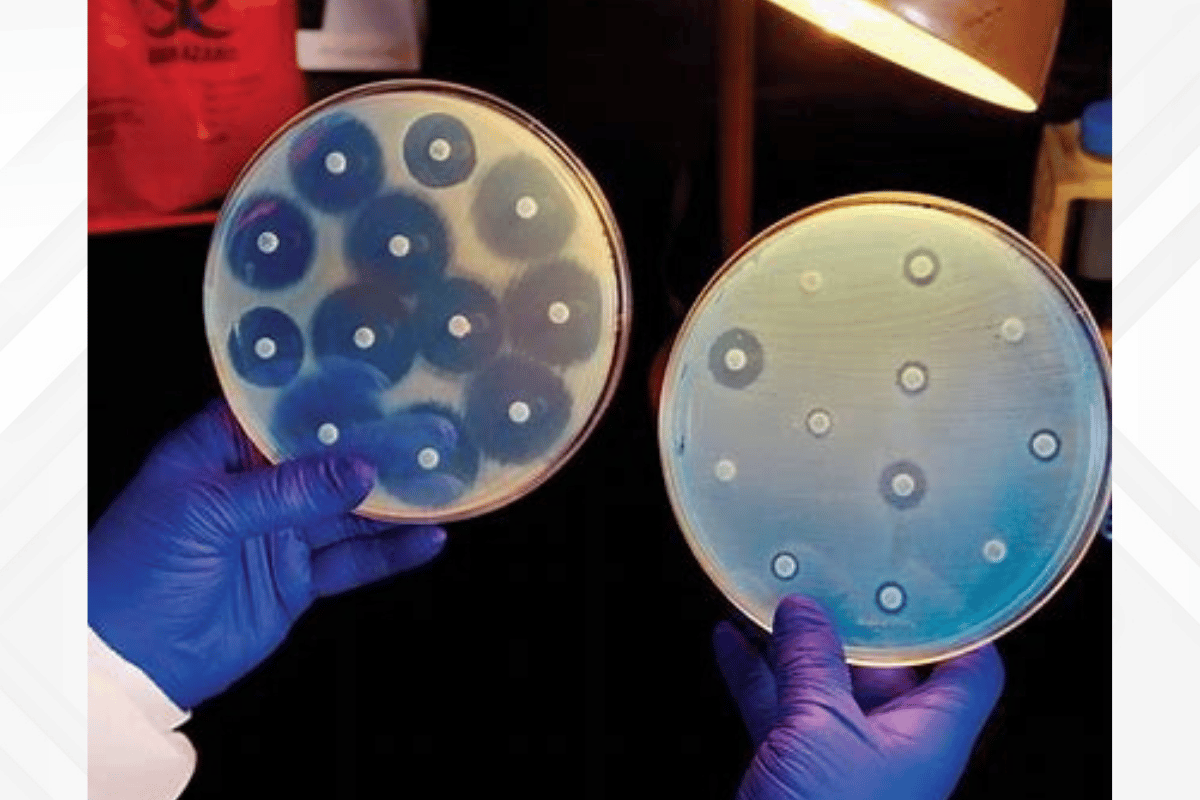 Petri dish showing zones of growth inhibition